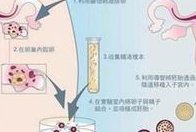 卵巢早衰运动锻炼小窍门是什么？卵巢早衰如何调理？