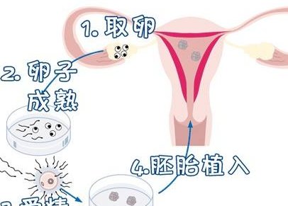 3一4月才来一次月经什么原因，不来月经怎么影响试管的？